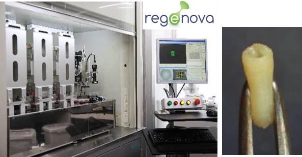 バイオ3DプリンターRegenova(左)、細胞のみからなる人工血管
